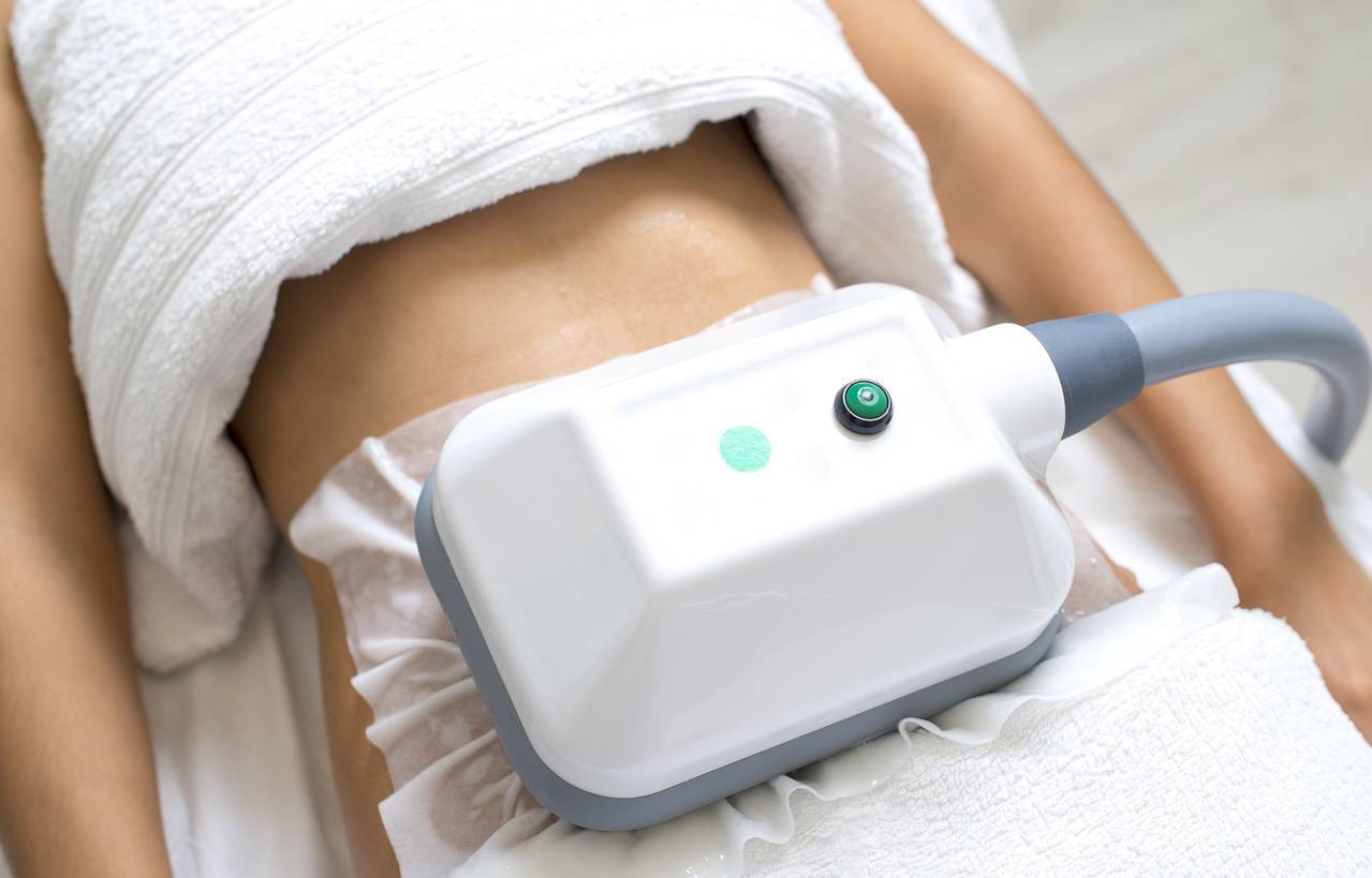 cryolipolyse pour éliminer la cellulite