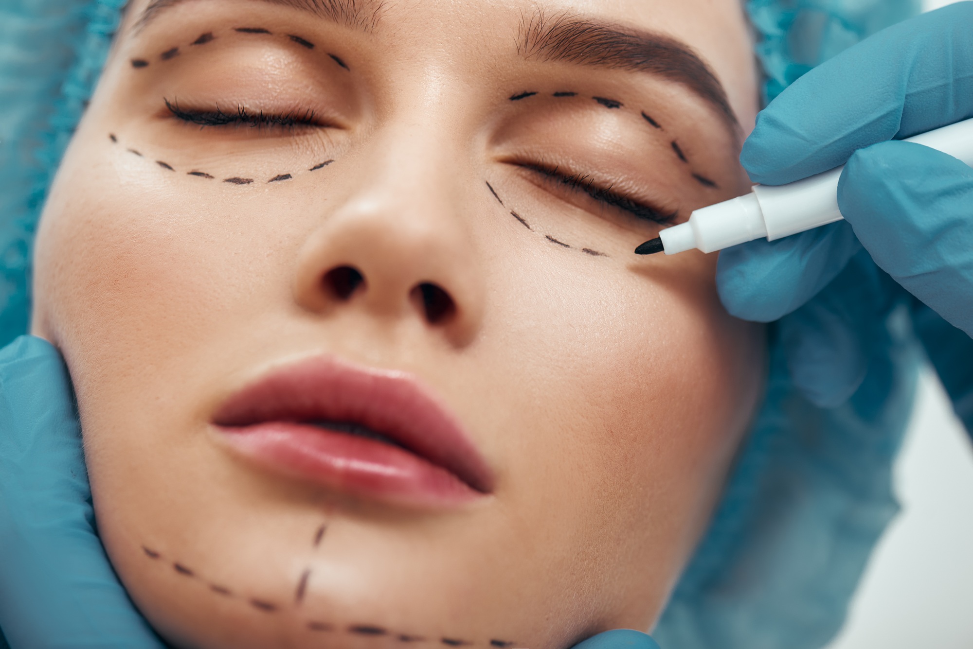 prix chirurgie esthétique