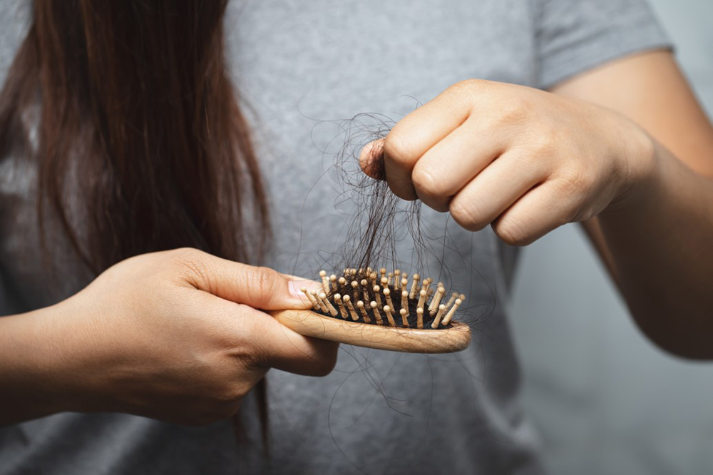 perte cheveux