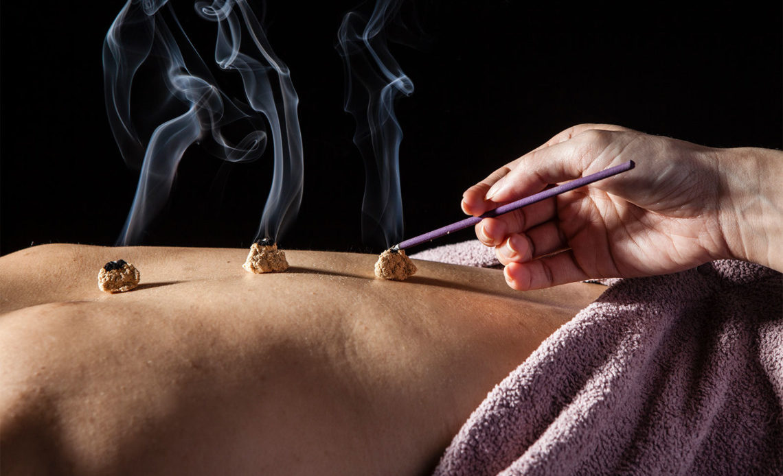 pratique de la moxibustion médecine chinoise