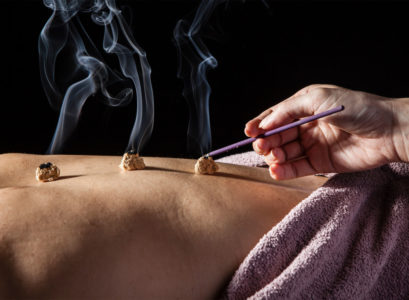 pratique de la moxibustion médecine chinoise